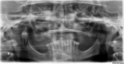 Martine eft9bq - Eugenol