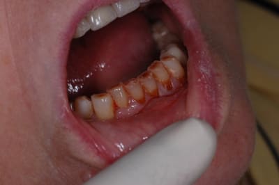 Me dubesset  1  dwsuae - Eugenol