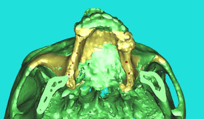 Med 3d i8fcbr - Eugenol