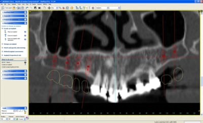 Medoverview ngdayl - Eugenol