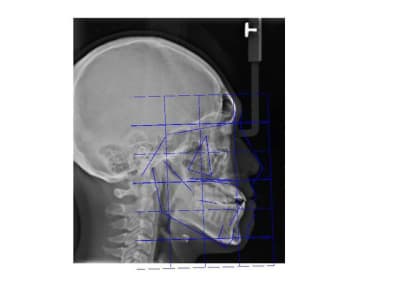 Mesh jnjeyq - Eugenol