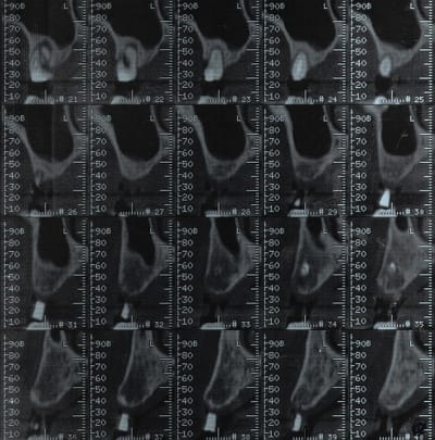Mfscan2 j3u8kq - Eugenol