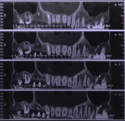 Mfscan4 hc6jma - Eugenol