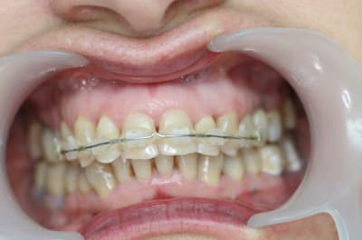 Mi2 qdbu0w - Eugenol