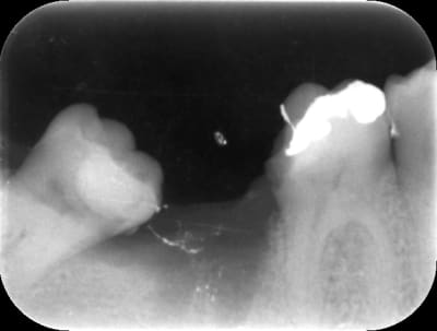 Milon tjc6nu - Eugenol