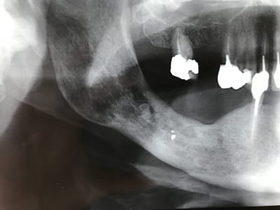 Mjxbhl92d18xodumr9y6 - Eugenol