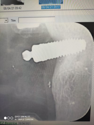 Ml1c3gzk0hcfxy1ulhda - Eugenol