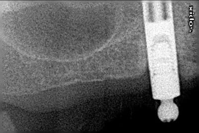 Mme x hkj6a5 - Eugenol