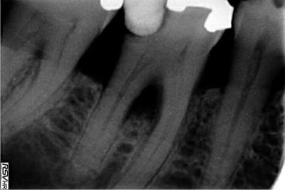 Mme x sgrrxa - Eugenol