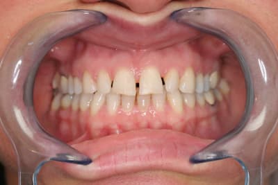 Mockup1 gztxd2 - Eugenol