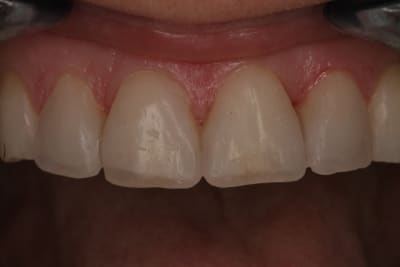 Mockup4 emsu5c - Eugenol