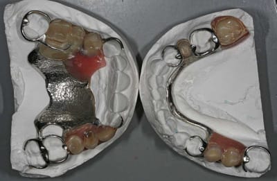 Modèles occlusal qed2vn - Eugenol