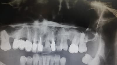 Mxcym3w0xv88utiwvbhm - Eugenol