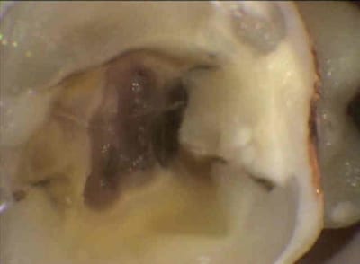 Nadal  hqsxf9 - Eugenol