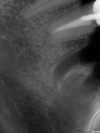 Ne3 uwbgjl - Eugenol