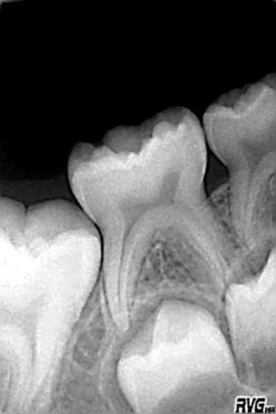 Novembre 05 jkphf8 - Eugenol