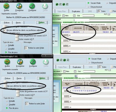 Numeros dents efwycp - Eugenol