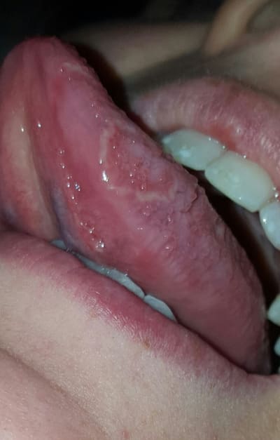 Oljkzte2bgs5icqpcp5d - Eugenol