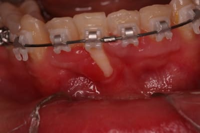 Oops gzxmey - Eugenol