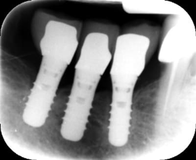 Orhwbsytf2p5zltxdjtb - Eugenol