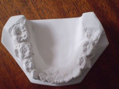Ortho05 wxbrv5 - Eugenol