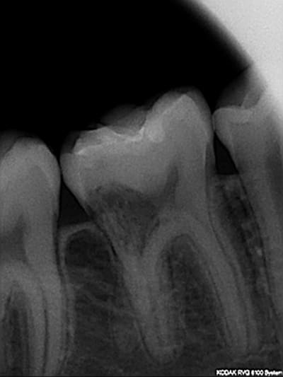 Orthocentr  yzpklh - Eugenol