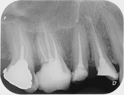 Outt tu2qgp - Eugenol