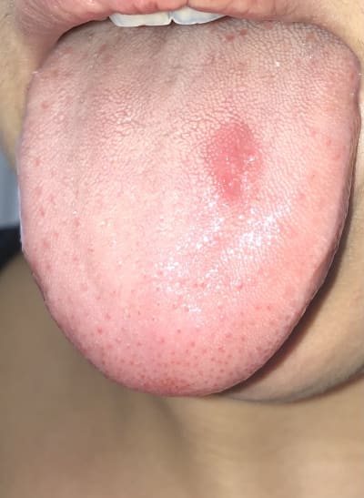 Owg0kuqgigyga5pidqn3 - Eugenol