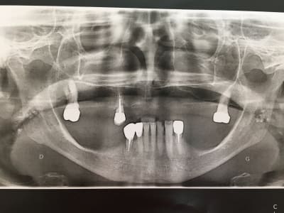 Ozqef88wcne3oklinwlj - Eugenol
