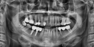 Ozt1sbdwj8fv0z1llq78qrsx7ejr - Eugenol