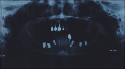 P1 g2udkz - Eugenol