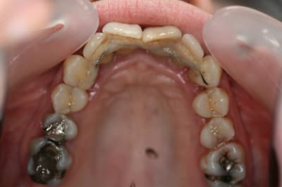 Palatin erqw5r - Eugenol