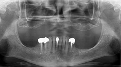 Pano dil rp4rr4 - Eugenol