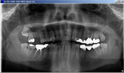 Pano pr op rvfkbl - Eugenol