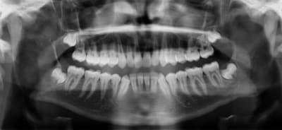Pano 2 e5sxsv - Eugenol