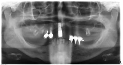 Pano a xwm2w5 - Eugenol