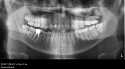 Pano b7tvzr - Eugenol
