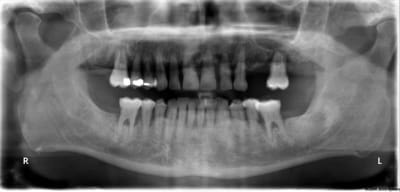 Pano f1f4xz - Eugenol