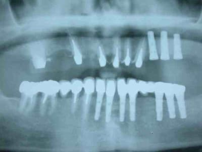 Pano fin 2003 tvspxp - Eugenol