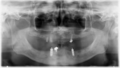 Pano i0a5sd - Eugenol