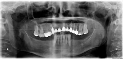 Pano lentiez olttaz - Eugenol