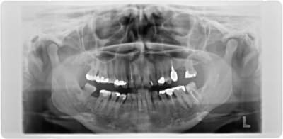 Pano ngirzz - Eugenol