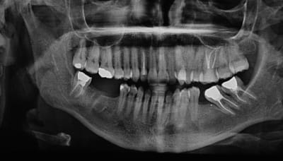 Pano nktiqq - Eugenol