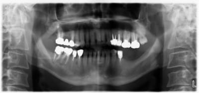 Pano oxw8hv - Eugenol