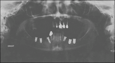 Pano rqwbkv - Eugenol