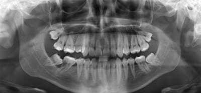 Pano sqmyh5 - Eugenol