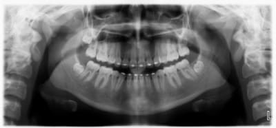Pano tvp3p8 - Eugenol