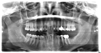 Pano vmzmmq - Eugenol