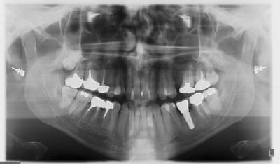 Panoexemple dnnyjr - Eugenol