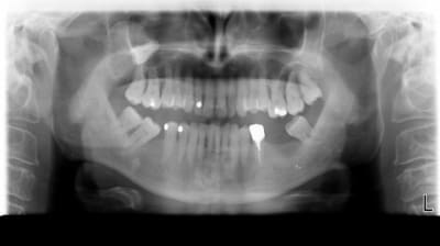 Panoramique99 dbz4zb - Eugenol